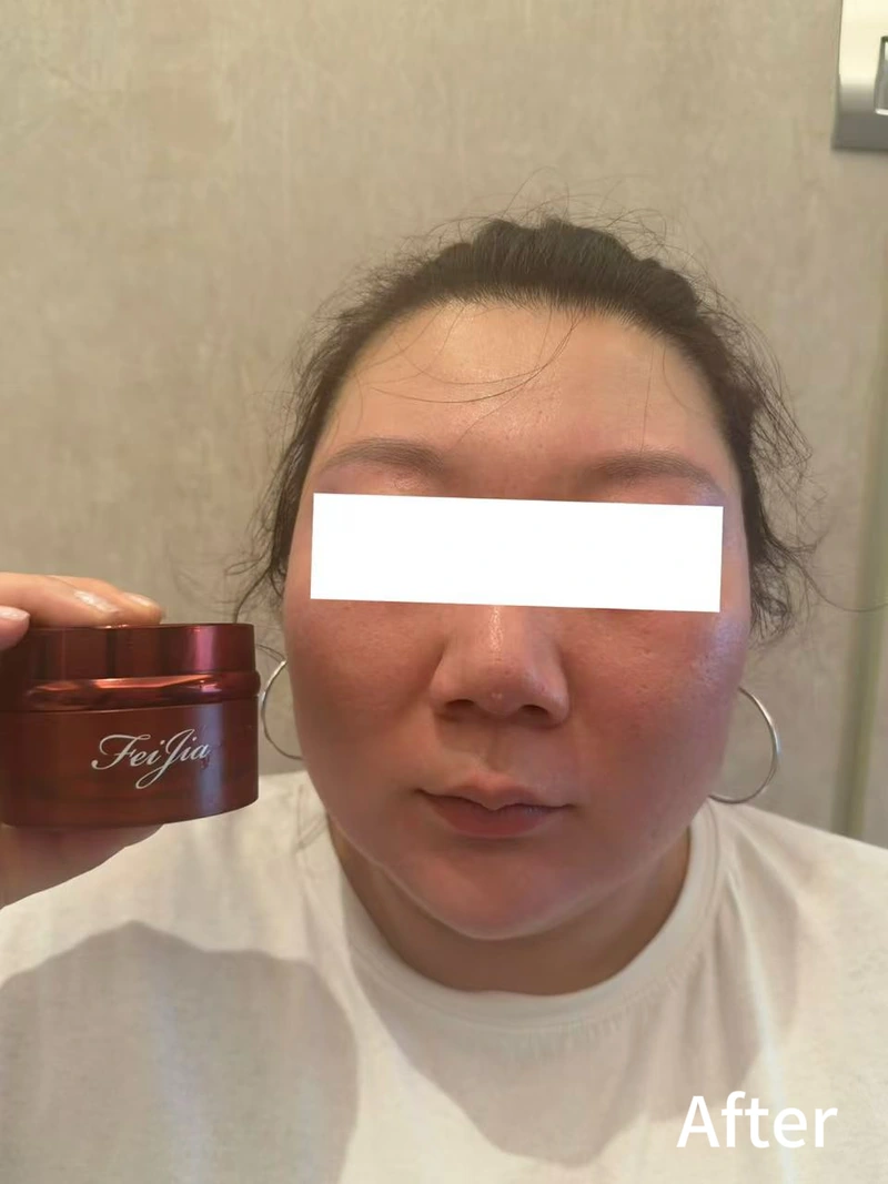 Cream user feedback photograph labelled After, with the eye area covered